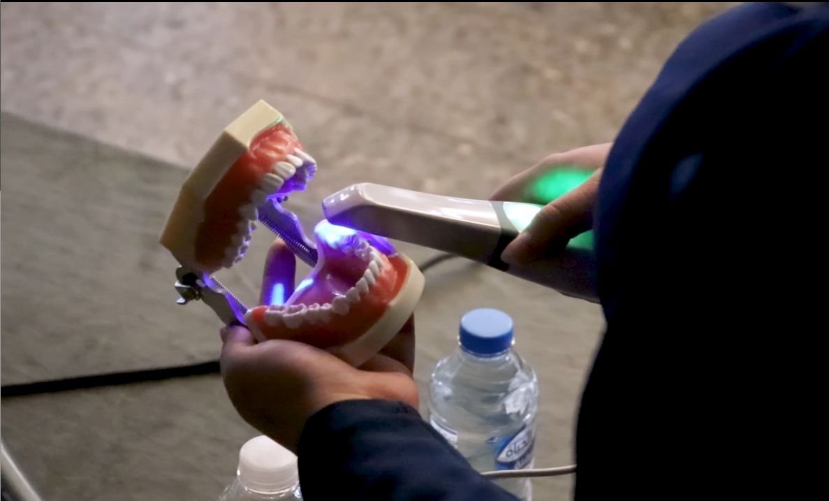 Live demonstration of an intraoral scanner