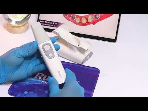 Runyes Intraoral Scanner V5 video