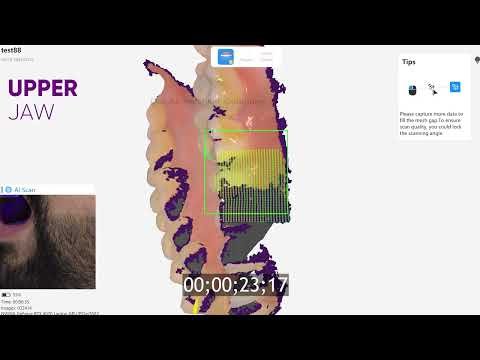 Runyes Intraoral Scanner V6 video